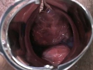 Senhora grávida japonês é examinado e suga lollicock attain médico